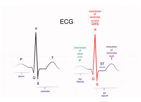 Illustration of ECG interpretation. ECG of a healthy person