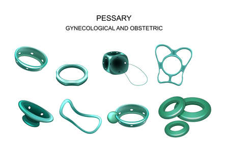 gynecological and obstetric pessaryのイラスト素材