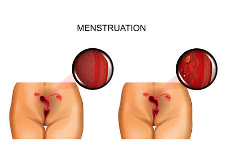 vector illustration of female reproductive organs. menstruationのイラスト素材