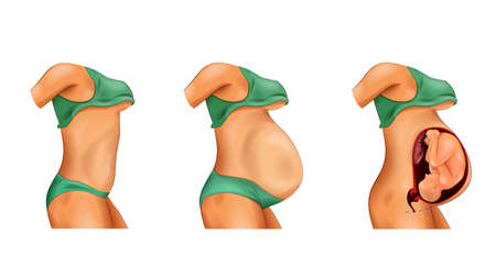 vector illustration of pregnancy in view of the profileのイラスト素材