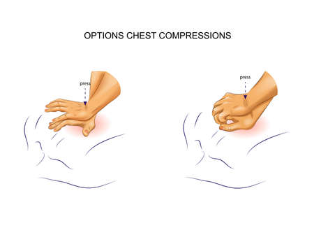 vector illustration of indirect heart massage options