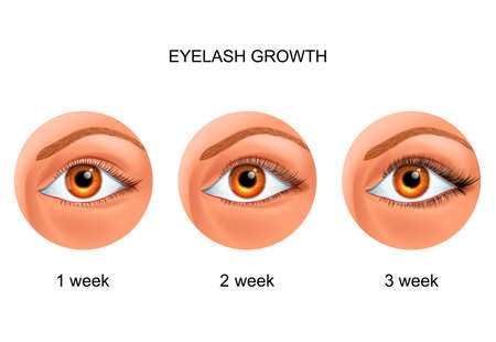 eyelash growth. before and afterのイラスト素材