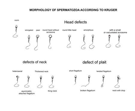 Illustration of the morphology of spermatozoa according to cruderの写真素材