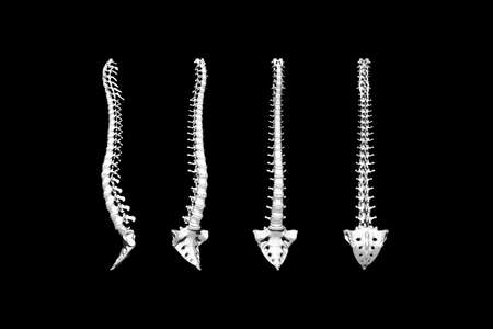 3d render of the spine and sacrum in different positionsの写真素材
