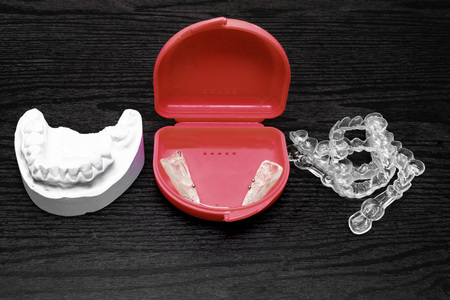 gypsum cast, different aligners clear and in box on wooden backgroundの写真素材