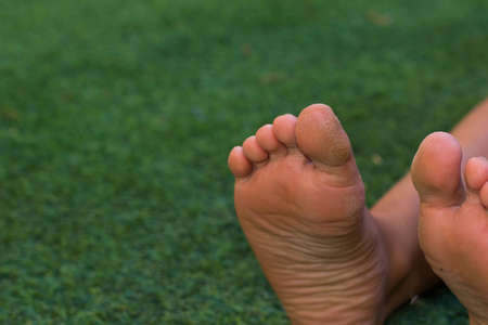 dermatology medical problems concept picture of cracked toes and heels of child bare feet, unfocused green background and empty space for copyの写真素材
