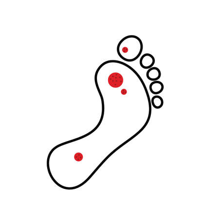 Plantar wart icon. Verruca symbol, foot corn, human papillomavirus sign, HPV infection, clavus pictogram, feet papilloma vector illustrationのイラスト素材