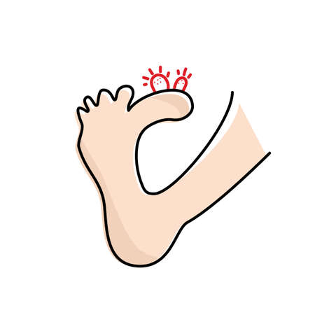 Plantar wart icon. Verruca symbol, foot corn, human papillomavirus sign, HPV infection, clavus pictogram, feet papilloma vector illustrationのイラスト素材