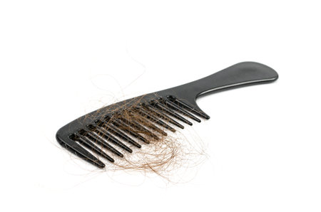 Comb with Hair Loss Isolated, Hair Fall on Brush, Scalp Health Care, Hair Losing, Baldness, Alopecia Problem Conceptの写真素材