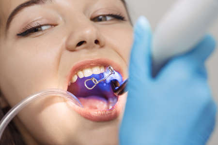 Dentist doing a dental treatment on a female patient. Surgery close-up.の写真素材