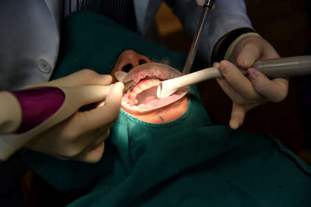 Dental care check up, Dentist examining and doing teeth treatment in dental clinic, Yearly visit for teeth cleaning and scaling to prevent gum disease problems, Healthy oral hygienic.の写真素材