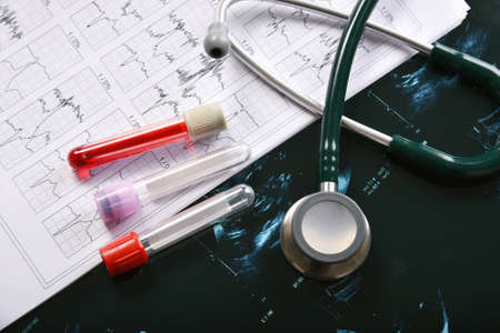 Blood examination testing, Coronavirus disease outbreak, Vaccine and new drug research for Covid-19 pandemic, Medical equipment for health check upの写真素材