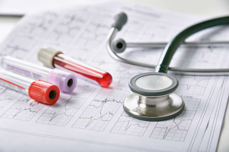 Blood examination testing, Coronavirus disease outbreak, Vaccine and new drug research for Covid-19 pandemic, Blood result and medical equipment for health check up.の写真素材