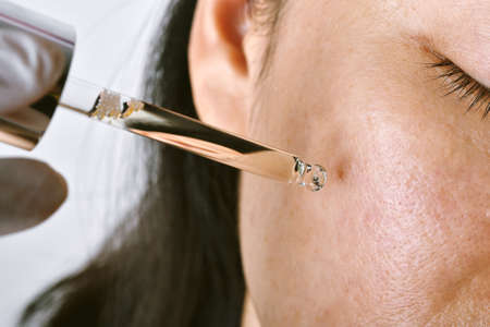 Facial skin problem, Aging problem in adult, wrinkle, acne scar, large pore and dark spot, Dehydrate...