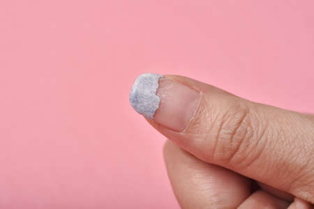 Cracked broken nail, Nail weakness damage from gel polish coating, Fingernail manicure hygiene.