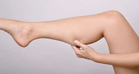 Calf fat, Fat woman pinching thigh leg skin, Overweight body test.