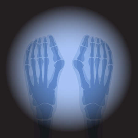 X Ray radiology legs. Healthcare. Treatment for internal oragns and bones.のイラスト素材