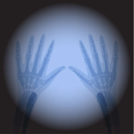 X Ray radiology hand. Healthcare. Treatment for internal oragns and bones.のイラスト素材
