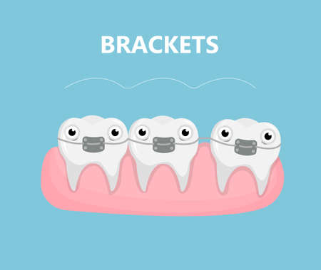 Teeth with brackets.のイラスト素材