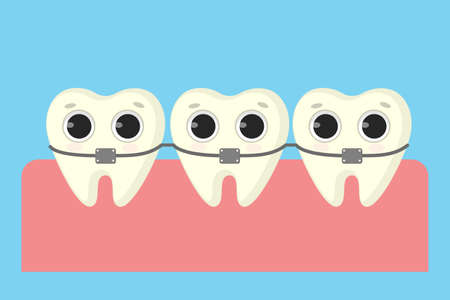 Teeth in braces. Cartoon funny teeth in mouth.のイラスト素材
