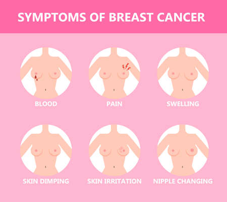 Breast cancer symptom. Idea of health and medicalのイラスト素材
