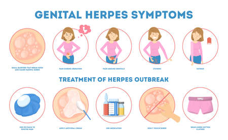Genital herpes symptoms. Infectious dermatology disease illustrationのイラスト素材