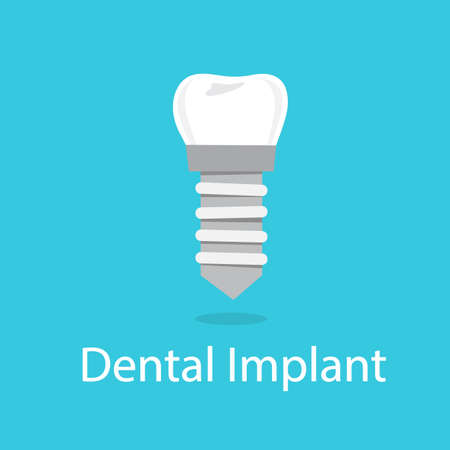 Dental implant. Medical treatment and dentistry. Implant in the jaw and tooth crown. Artificial porcelain element. Vector illustration in cartoon styleのイラスト素材