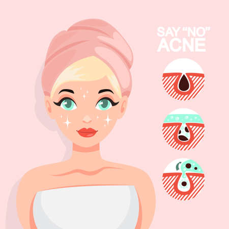 Acne treatment with face mask. Idea of beautyのイラスト素材