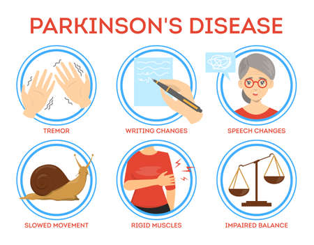 Parkinson disease symptoms infographic. Idea of dementia and neurology illness. Tremor and memory loss. Isolated vector illustration in cartoon styleのイラスト素材