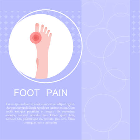 Concept of foot callus. Pain markers on foot.のイラスト素材