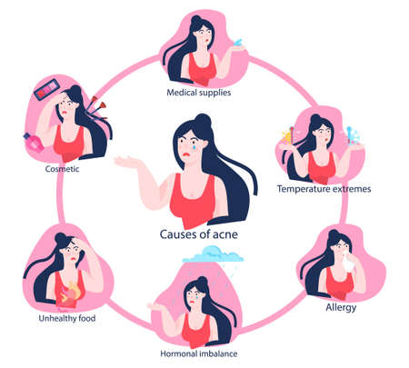 Acne causes infographics. Young woman with pimple on skin.のイラスト素材