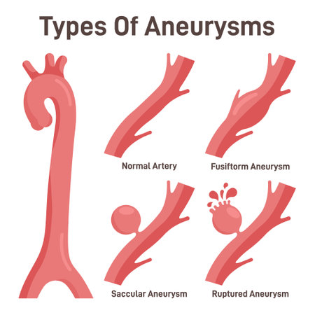 Thoracoabdominal aortic aneurysms types. Healthy aorta and aortaのイラスト素材