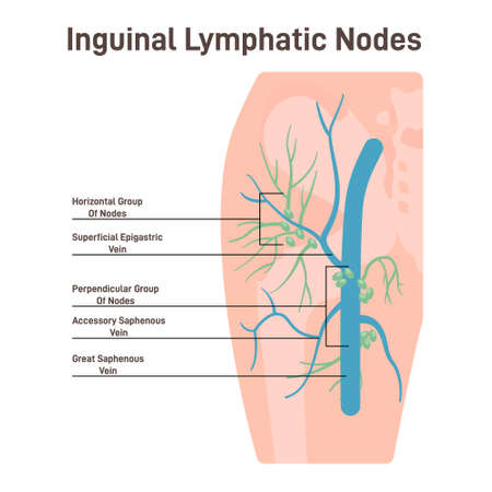 Inguinal lymph node. Fluid exchange, body defense from infectionのイラスト素材