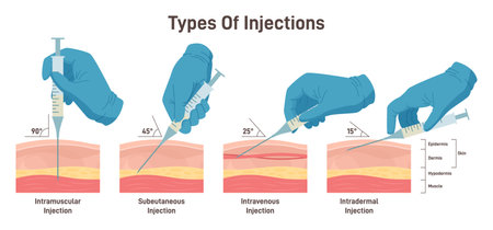 Types of injections. Guide to injecting medication into skin. Doctor holdingのイラスト素材