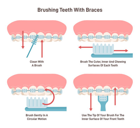 Brushing teeth with braces system. Oral care with special brush.のイラスト素材