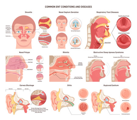 Common ENT diseases set. Nose, throat and ears bacterial infectionsのイラスト素材