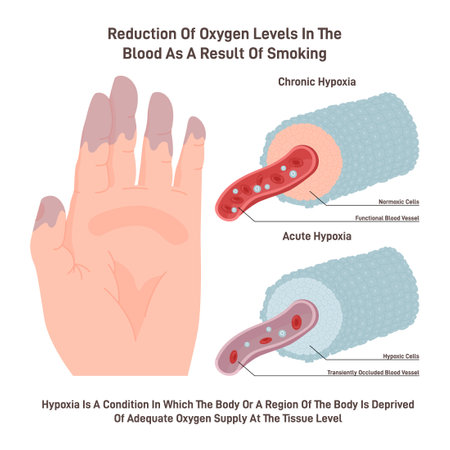 Chronic hypoxia. Dangerous effect of smoking on oxygen supply.のイラスト素材