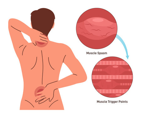Back pain. Character having neck and shoulder muscle spasm. Triggerのイラスト素材
