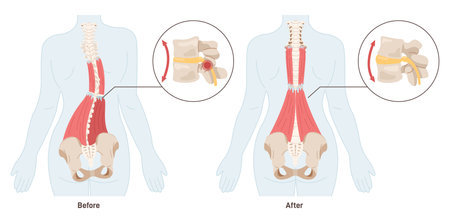 Massage effect. Back pain treatment and muscles relaxation. Spasmedのイラスト素材