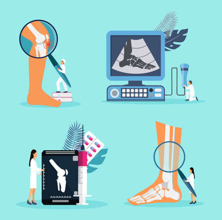 Arthritis knee joint, osteoporosis concept vector. Tiny doctors treat rheumatism, osteoarthritis, make x ray scan. Healthcare flat illustrationのイラスト素材