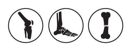 Arthritis icon. Osteopath practice. Osteoporosis sign, osteoarthritis anatomical vector. Joint pain,...