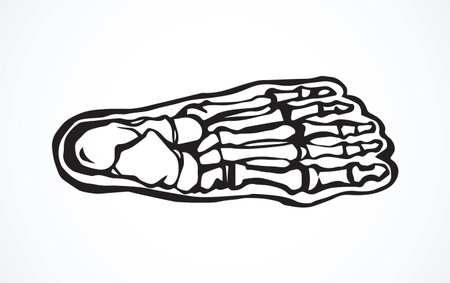 Healthy limb posture section element diagnostic concept on white text space. Black line hand drawn hip medial care logo pictogram in doodle art vintage style. Analysis abstract frontal above top viewのイラスト素材