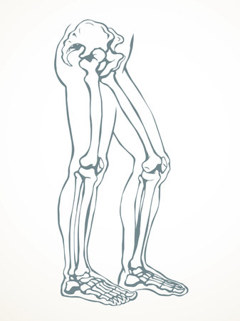Front view old woman sick injury toe muscl tissue part ache hospital surgery care scan x ray radius white logo Black hand drawn femal upper fibular ankle injur medic xray ill pain exam line sketch artのイラスト素材