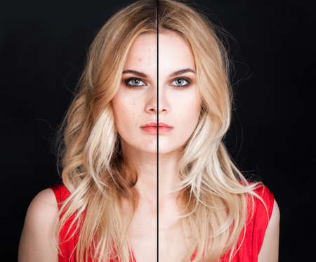 Young Woman with Skin Problem and Clear Skin Female Face Closeup Portrait. Unhealthy and Healthy Skin After Treatment or Retouch on Black Backgroundの写真素材