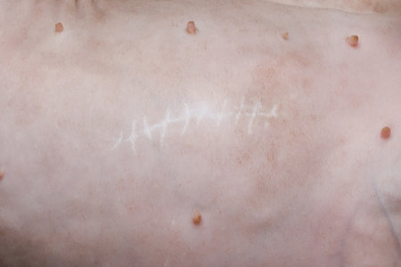 Animal stomach with suture scar after neutering surgery close upの写真素材