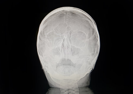 Human anatomy. Head X-rayの写真素材