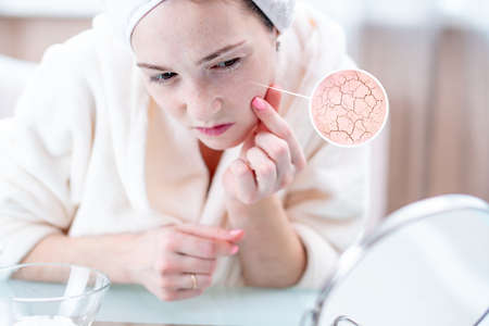 Beautiful young woman with a towel on her head looking at her dry skin with cracks and with first wrinkles. Circles increase the skin like a magnifying magnifierの写真素材