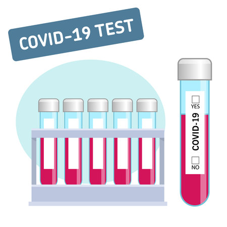 Vector stock illustration. COVID-19 virus test result. Test tube laboratory analysis. Design information to become a web publishing instruction.のイラスト素材