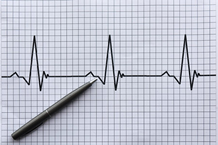 Pulse and business. Business chart and pen. Business concept pen and chart.