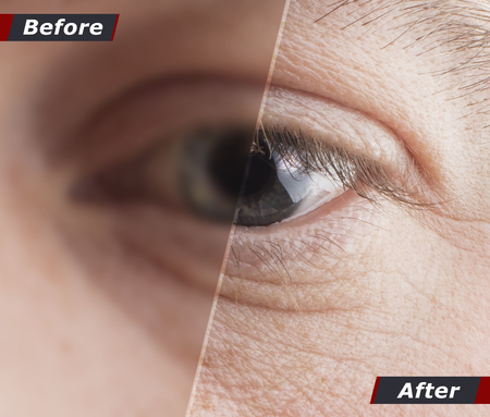 Technological concept, one hundred percent recovery of vision. Contact lenses. Good vision. Before and after. Copy spaceの写真素材